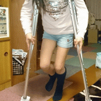 松葉杖で騒ぐ姉